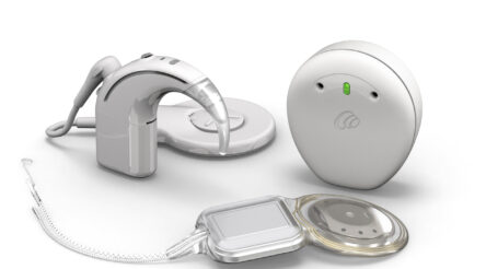 Image for Cochlear launches world’s first smart hearing implant system