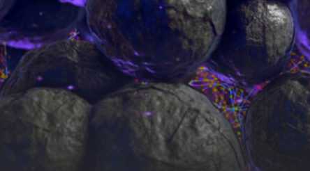 Image for AnteoTech targets high-value medical device market with Wyon’s trial of Ultranode