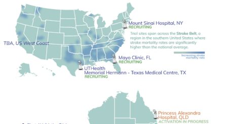 Image for EMVision advances bedside brain scanner trials across two continents