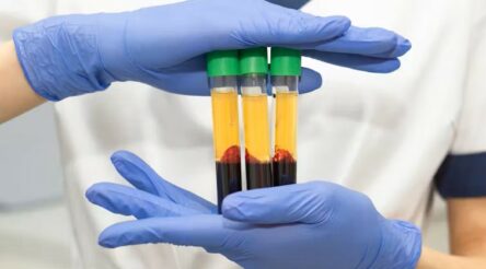 Image for Trump has flagged 200% tariffs on Australian pharmaceuticals. What do we produce here, and what’s at risk?