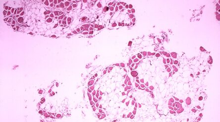 Image for Monash Ventures Pre-Seed Fund invests $2.25 million in three biotech spinouts